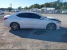 Acura TLX Image 2